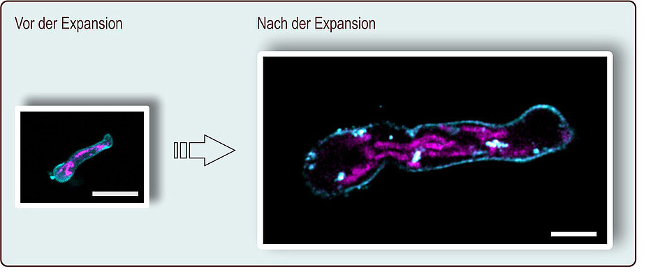 Bei der Expansionsmikroskopie wird das Präparat um mehr als das Vierfache vergrößert. Hier ist ein Keimschlauch von Aspergillus fumigatus vor und nach der Expansion zu sehen; der Maßstab entspricht zehn Mikrometern. Gefärbt wurden die Plasmamembran (türkis) und die Mitochondrien (pink).