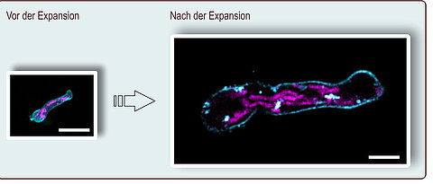 In expansion microscopy, the preparation is magnified more than four times. Here, a germ tube of Aspergillus fumigatus is shown before and after expansion; the scale corresponds to ten micrometers. The plasma membrane (turquoise) and the mitochondria (pink) were stained. (Picture: Ulrich Terpitz / University of Würzburg)