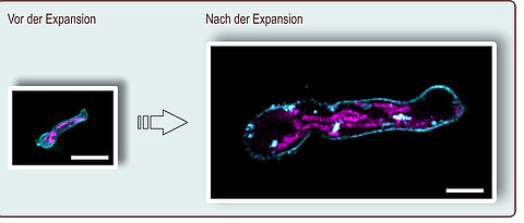 Bei der Expansionsmikroskopie wird das Präparat um mehr als das Vierfache vergrößert. Hier ist ein Keimschlauch von Aspergillus fumigatus vor und nach der Expansion zu sehen; der Maßstab entspricht zehn Mikrometern. Gefärbt wurden die Plasmamembran (türkis) und die Mitochondrien (pink).