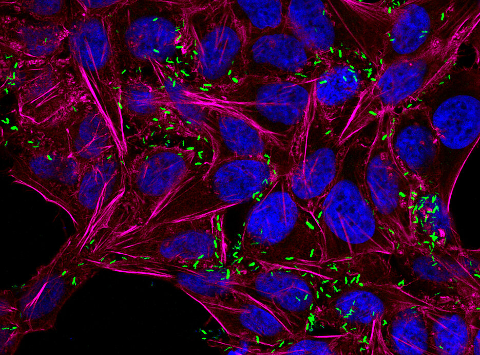 This fluorescence microscopy image shows Campylobacter jejuni bacteria (green) that have infected human cells (HeLa). The nuclei of host cells are stained in blue and the cytoskeleton (actin) in magenta, respectively.