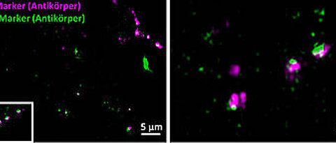 Synapses of brain cells made visible using conventional fluorescence tagging based on antibodies: The pre-synapses (red) and the post-synapses (green) appear slightly out of focus; the synaptic cleft is not fully resolved.