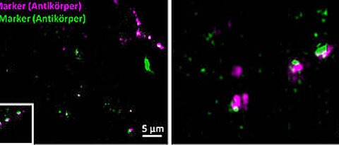 Synapsen von Gehirnzellen, mit konventioneller Fluoreszenzmarkierung auf Antikörperbasis sichtbar gemacht: Die Pre-Synapsen (rot) und die Post-Synapsen (grün) erscheinen leicht unscharf; der synaptische Spalt ist nicht vollständig aufgelöst. (Bild: Fr