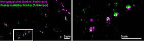 Synapsen von Gehirnzellen, mit konventioneller Fluoreszenzmarkierung auf Antikörperbasis sichtbar gemacht: Die Pre-Synapsen (rot) und die Post-Synapsen (grün) erscheinen leicht unscharf; der synaptische Spalt ist nicht vollständig aufgelöst. (Bild: Fr