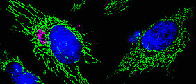 Primary HUVECS expressing GFP targeted to the mitochondria. One of the HUVEC is infected with Chlamydia, stained against HSP60 (magenta).