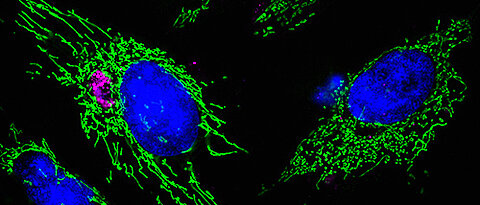 Zwei Zellen, links nach einer Infektion mit Chlamydia-Bakterien, rechts ohne. Obwohl beide Zellen mit einer Substanz behandelt wurden, die das mitochondriale Netzwerk zerstört, bleibt das Netzwerk in der infizierten Zelle intakt. (Abbildung: Suvagata Roy