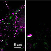 Synapsen von Gehirnzellen: Hier sind die Pre-Synapsen konventionell mit Antikörpern markiert (rot), die Post-Synapsen mit speziellen Peptiden, was die Auflösung deutlich verbessert. Post-Synapsen und Synapsen sind mit einer Auflösung von etwa 130 Nanom