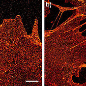 Diese dSTORM-Abbildung zeigt die Glycocalix der Plasmamembran von Zellen mit der homogenen Verteilung verzuckerter Proteine und Lipide. Die Visualisierung und Quantifizierung der Zucker auf der Zelloberfläche ist von besonderem Interesse bei der Erforsch