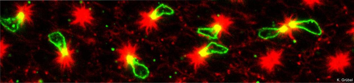 Opsin expression