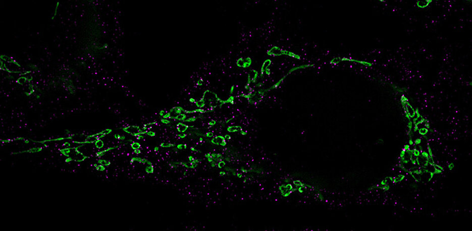 Mikroskopische Aufnahme, die den Zerfall der Mitochondrien zeigt.