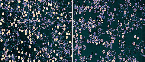Resting Chlamydia (left; bright circles), which are held without glutamine. After the addition of glutamine (right) the bacteria enter the division stages (darker circles).
