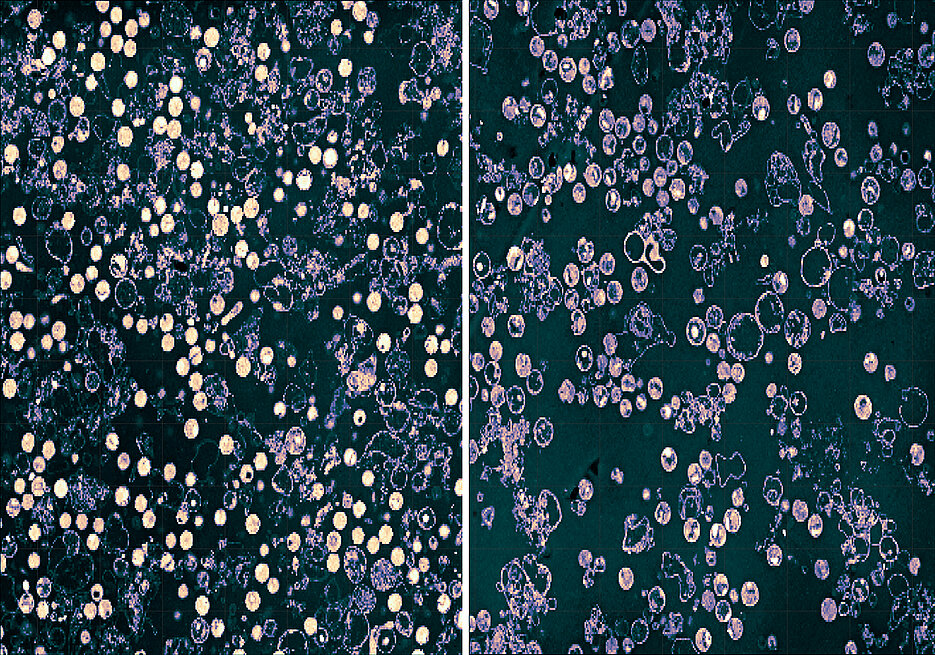 Resting Chlamydia (left; bright circles), which are held without glutamine. After the addition of glutamine (right) the bacteria enter the division stages (darker circles).